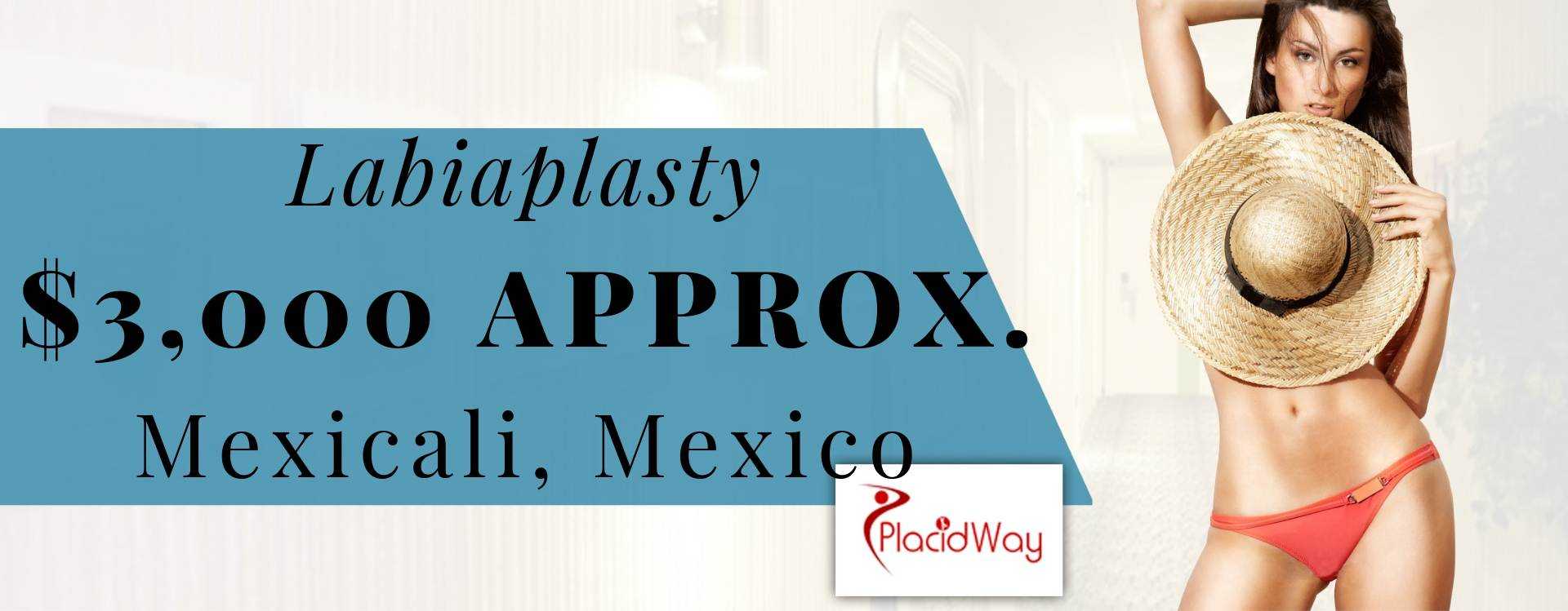 Labioplastia en Mexicali, México Labiaplasty in Mexicali, Mexico